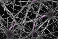 Hippocampal neurons in culture labeled for microtubules (grey) and ß4-spectrin (magenta).
