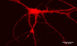 lck-scarlett neuron